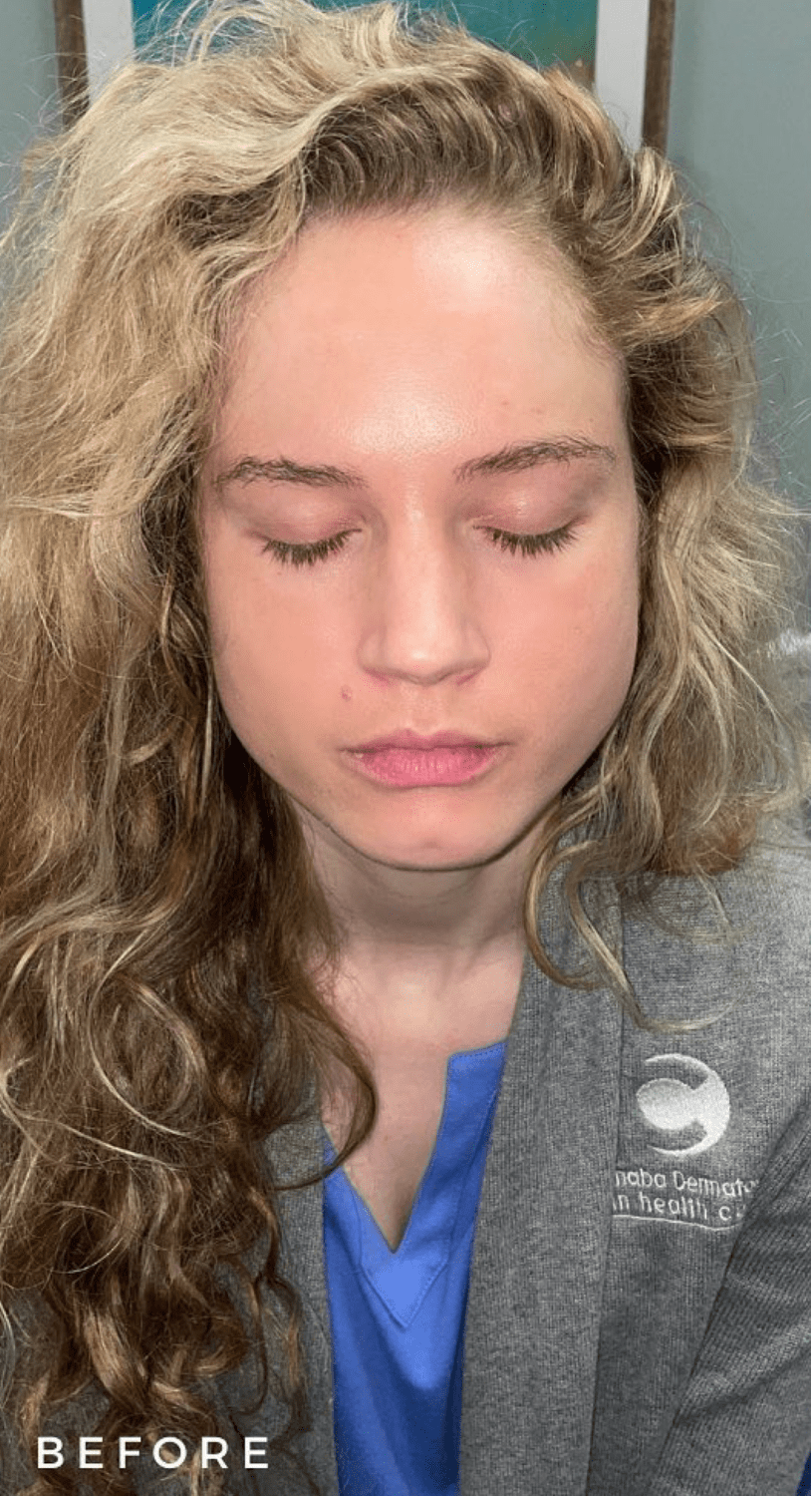 Lash & Brow Tint before - Spa Services and Spa Treatment in Birmingham | Spa Cahaba